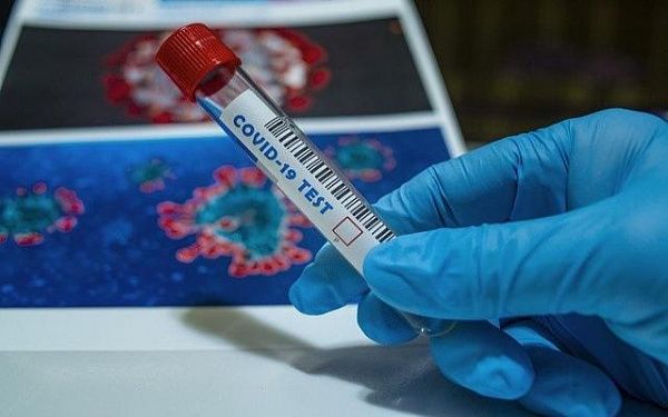 В Бурятии 671 человек болеет коронавирусной инфекцией