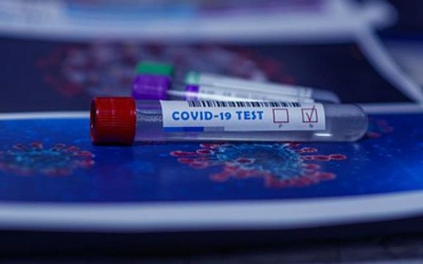 Около 210 тысяч тестов на коронавирус проверено в лабораториях республики с начала пандемии