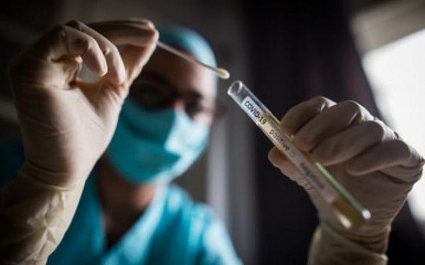 В Бурятии за сутки коронавирус подтвердился у 141 человека
