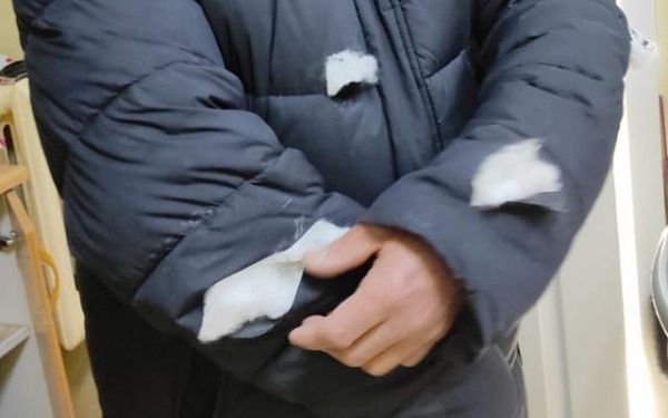 В Улан-Удэ на ул. Павлова хозяйская бойцовская собака едва не загрызла мужчину