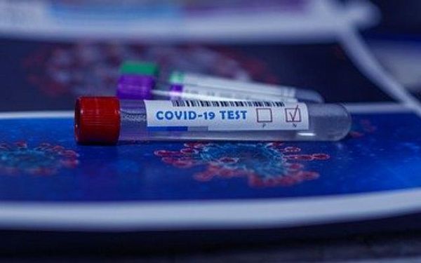 Компания из Бурятии разрабатывает экспресс-тест на коронавирус
